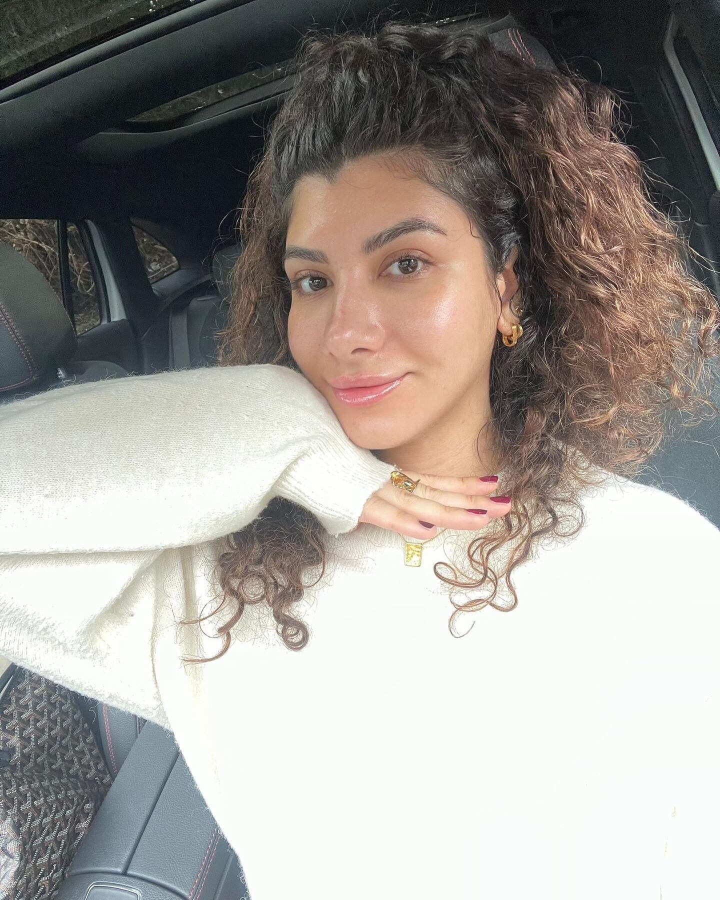 ✨ Glowing post-Metabolic Peel! ✨ Check out this stunning results from my beautiful client. 😍 

Experience a slight dryness initially, but in just 6/7 days, your skin will shine with even tone, defined pores, and a healthier glow 💛 

You have two op