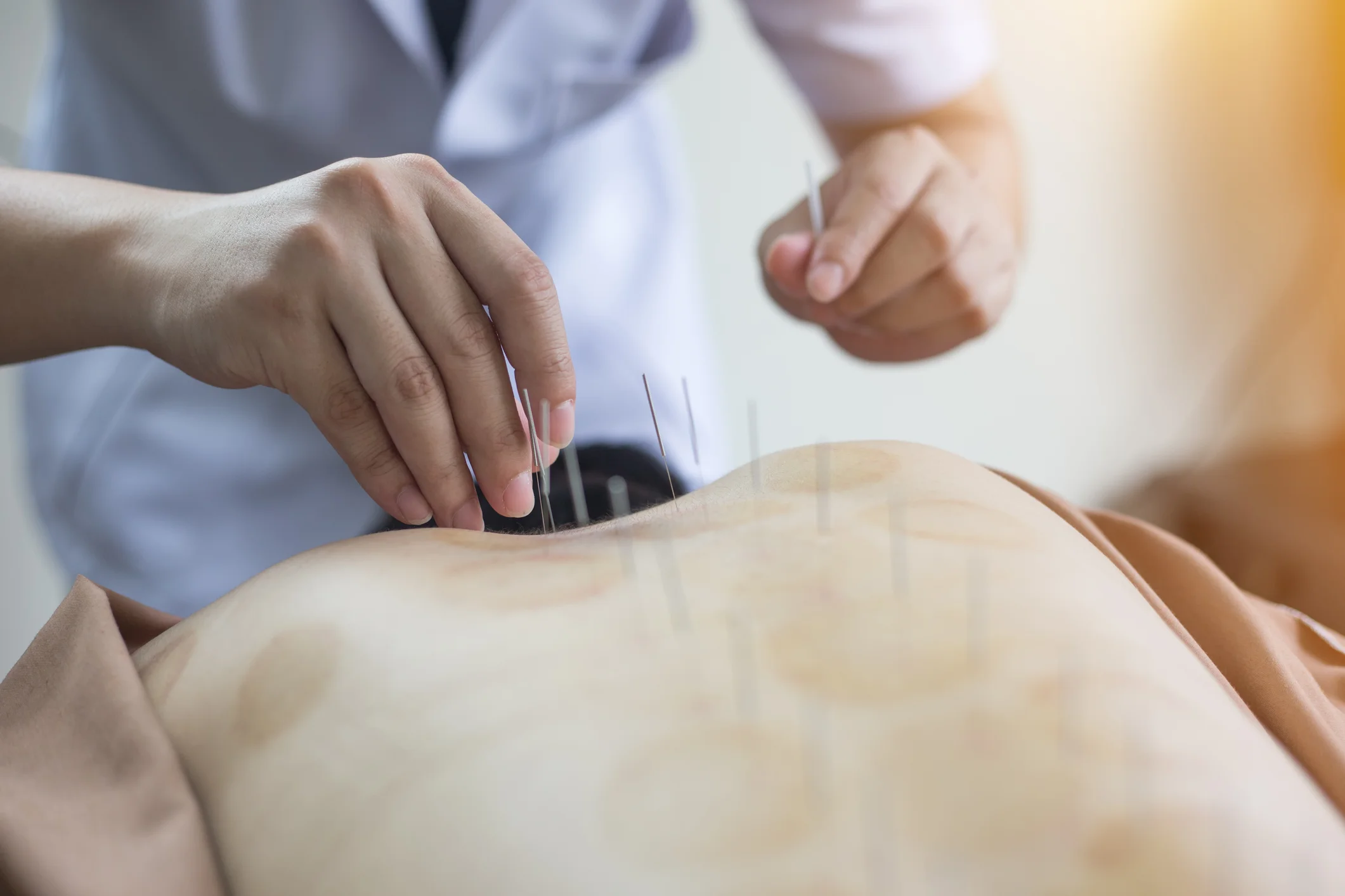 With acupuncture, the paths to health are many.