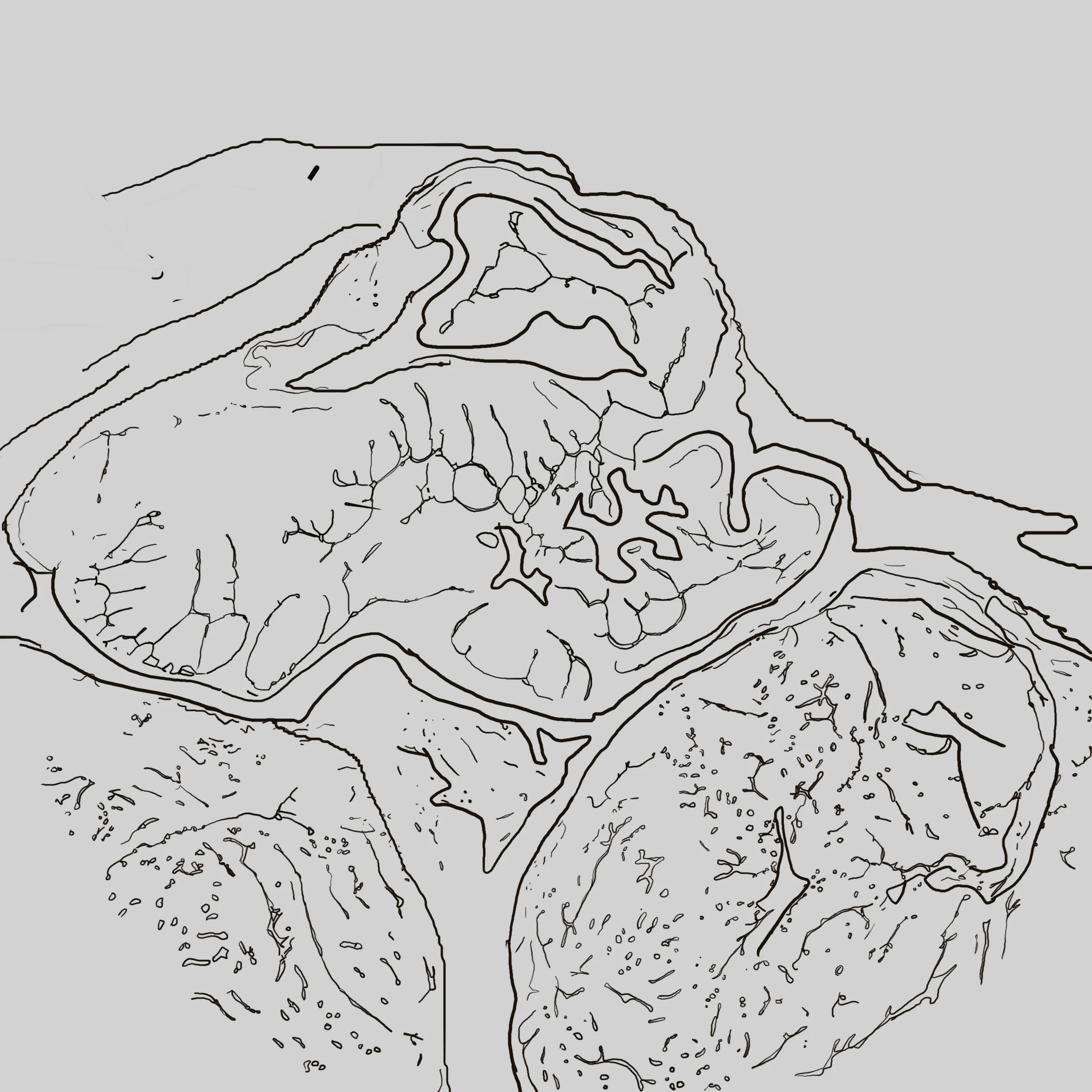 fibroadenoma.jpg