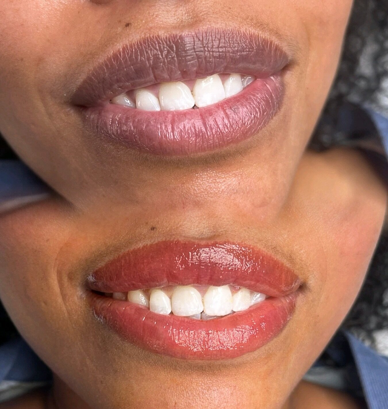 Neutralization session number one! These lips will need at least one more session before achieving our goal of a pretty nude pink color. Great progress today with @permablend_pigments 💄 

To schedule your lip blush appt, head to microbladingbynicole