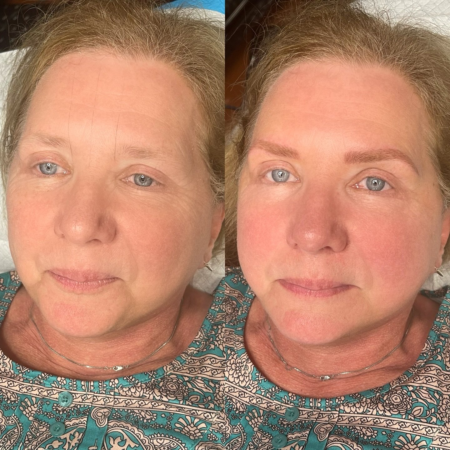 Sometimes you don&rsquo;t realize what brows can do for your face until you finally have them ✨ 

Book your appointment at elysiumpermanentmakeup.com in time for the holidays!

#knoxvillemicroblading #microbladingknoxville #new2knox #knoxvillebeauty 