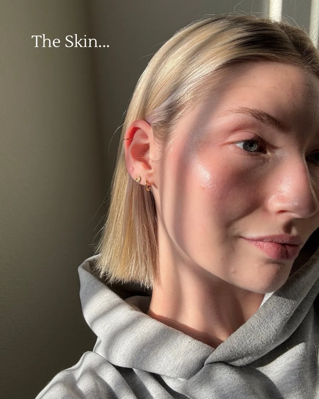 The skin speaks for itself&hellip; ✨

This is what happens when you treat acne intelligently &mdash; not aggressively.
Barrier supported, inflammation calmed, glow restored.

My current lineup is all about balance:
clarity + hydration + protection.

