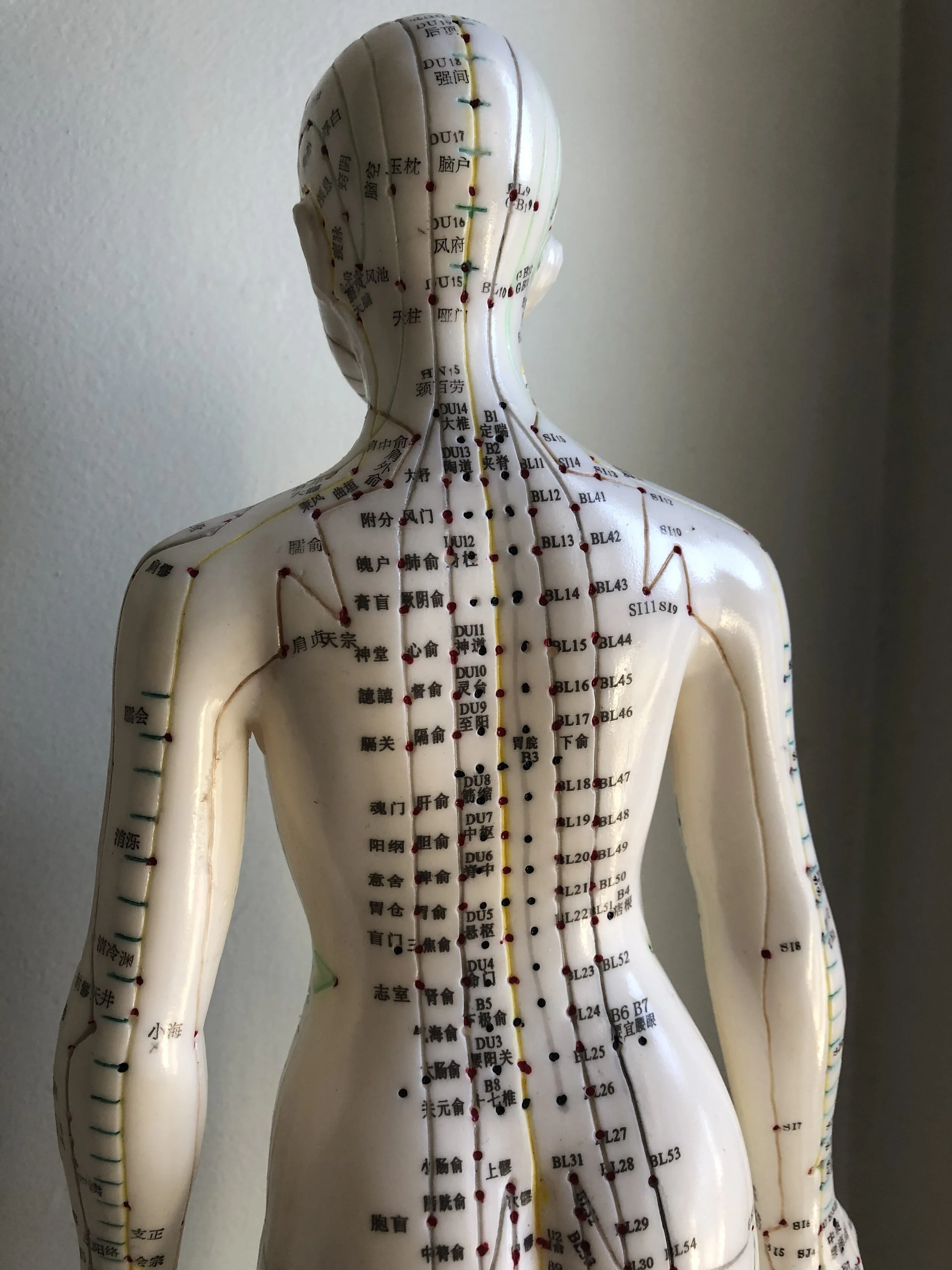 Traditional Chinese Medicine 101: What is Cupping? 