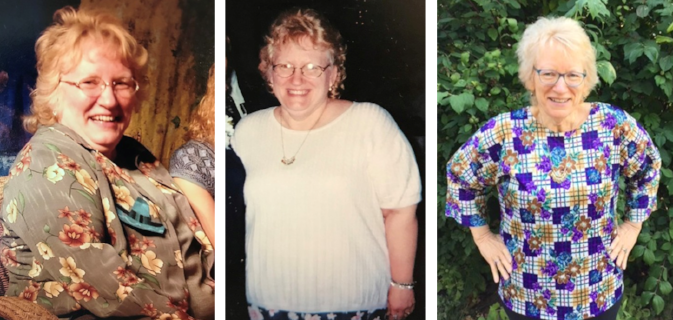 Rosie before. . .and currently.