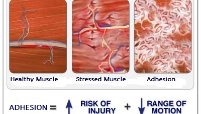 adhesion-1.jpg