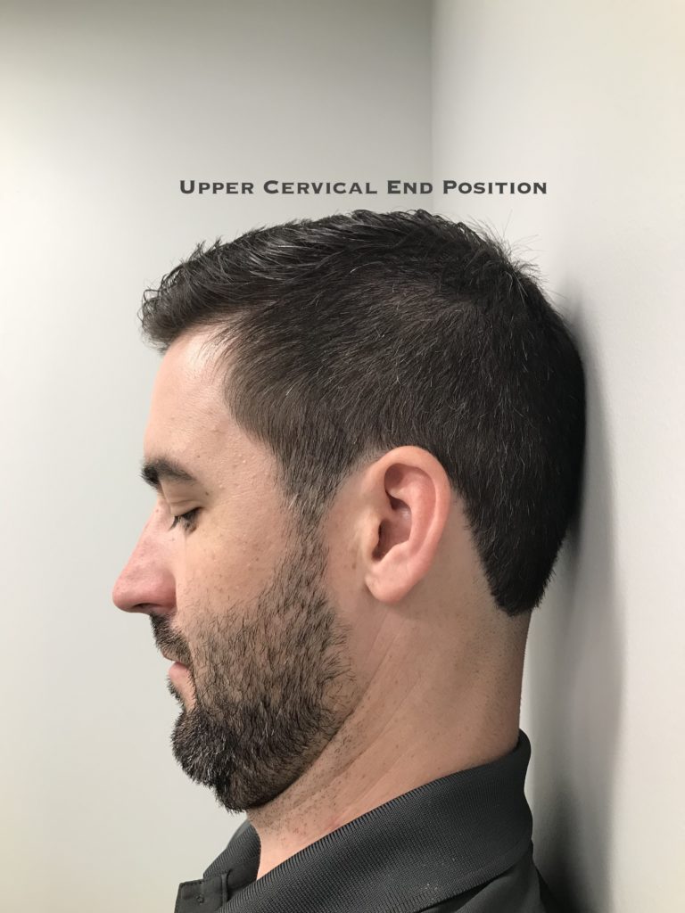 Upper neck test end position. Healthy motion is smooth, pain-free, and easy.