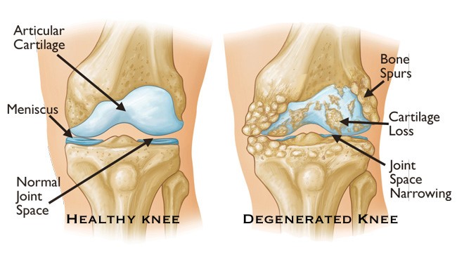 FSS-Knee3.jpg