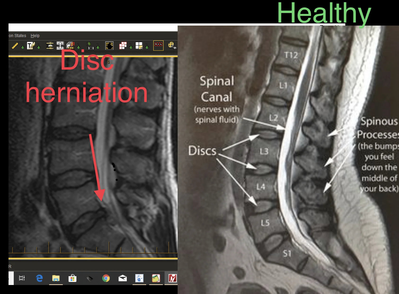 Joe T MRI.jpg