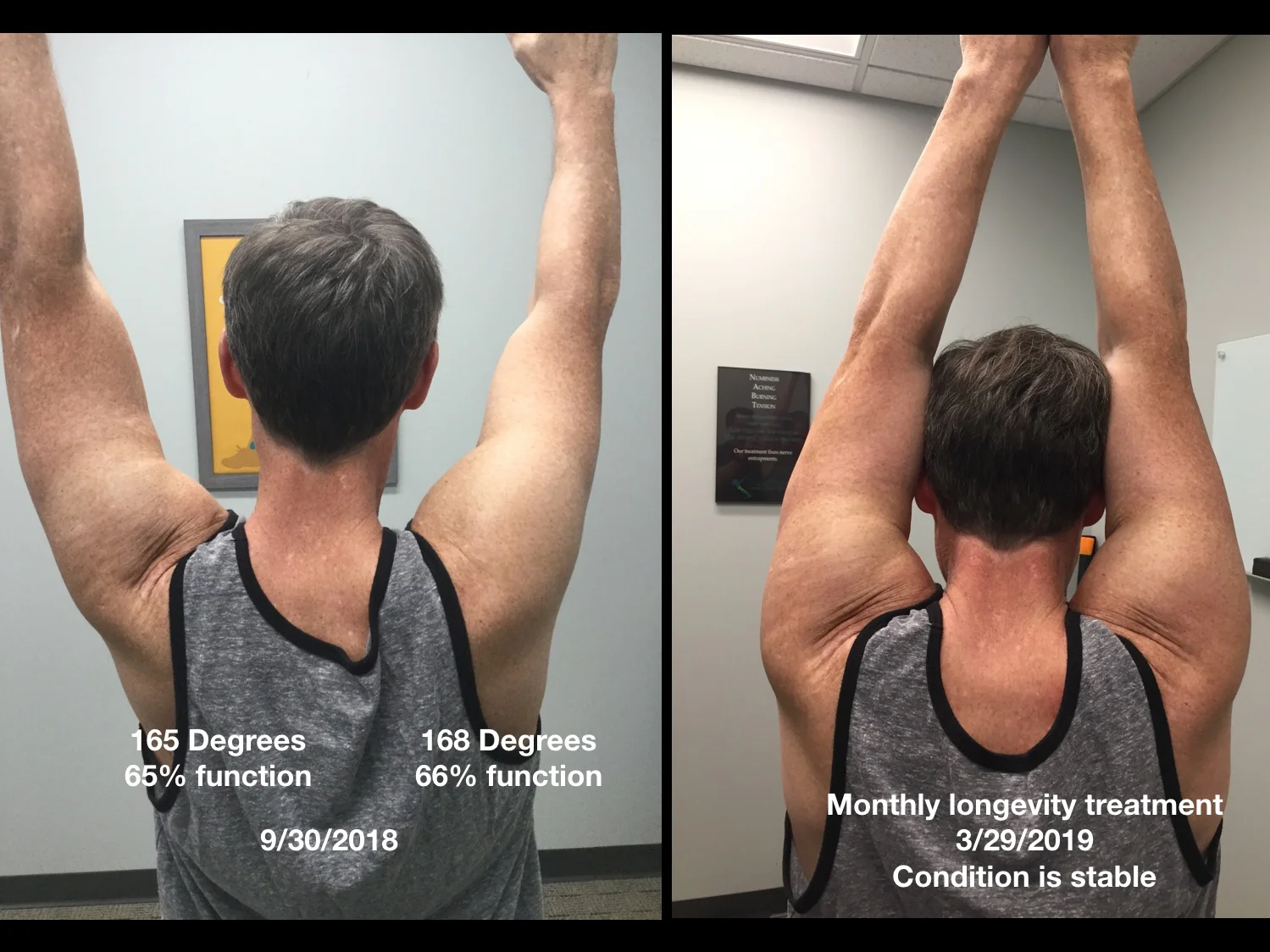 Piercing Shoulder Pain When Getting Dressed?