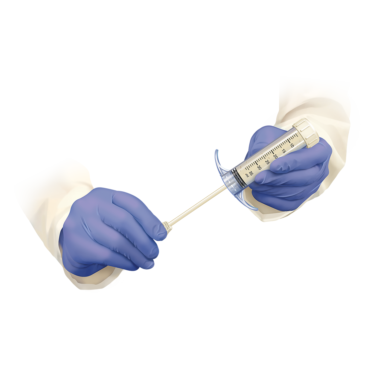 Prodense step 5.png