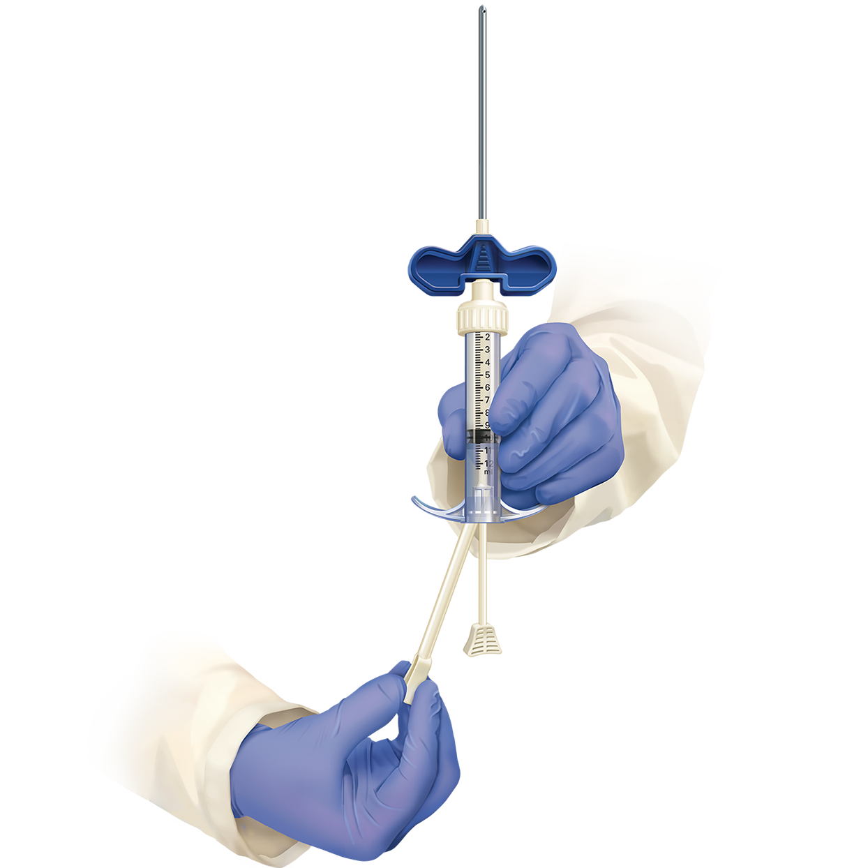 Prodense step 10.png