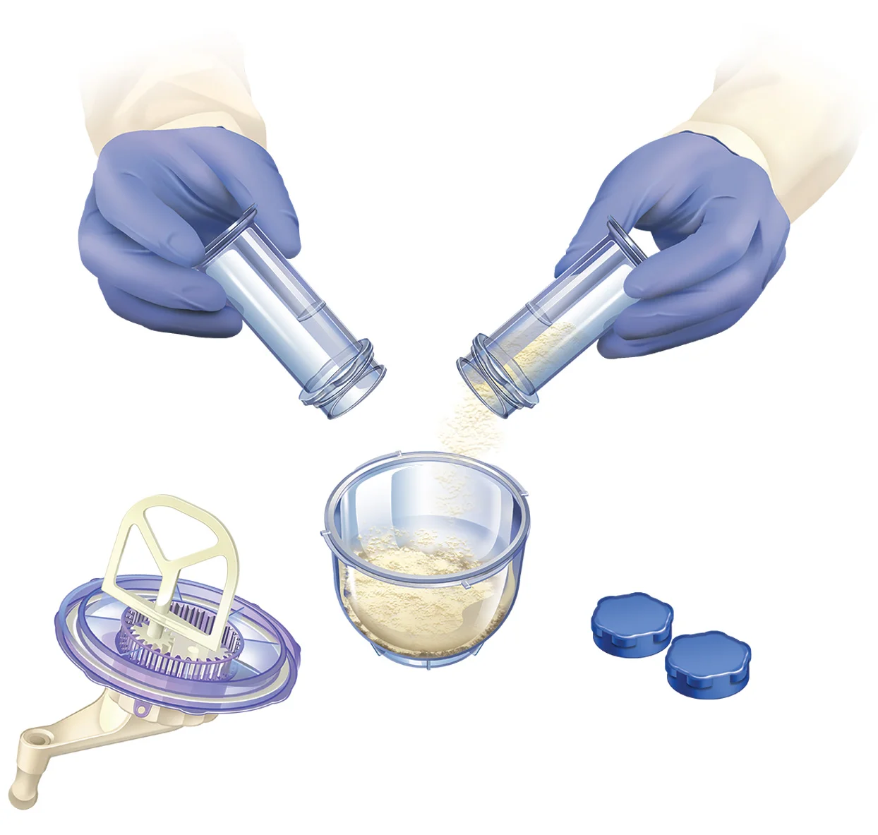 Prodense step 1.jpg