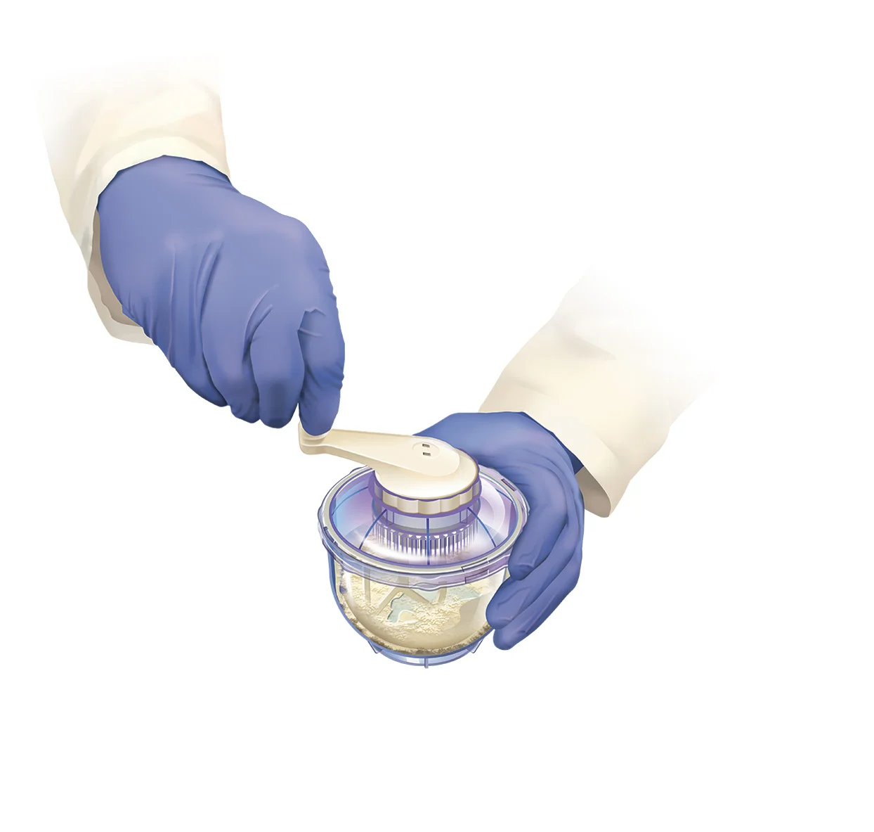 Prodense step 3.jpg
