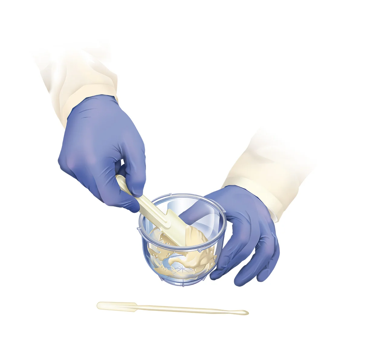 Prodense step 4.jpg