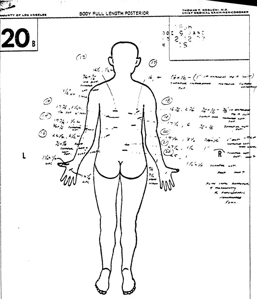 autopsy2.jpg