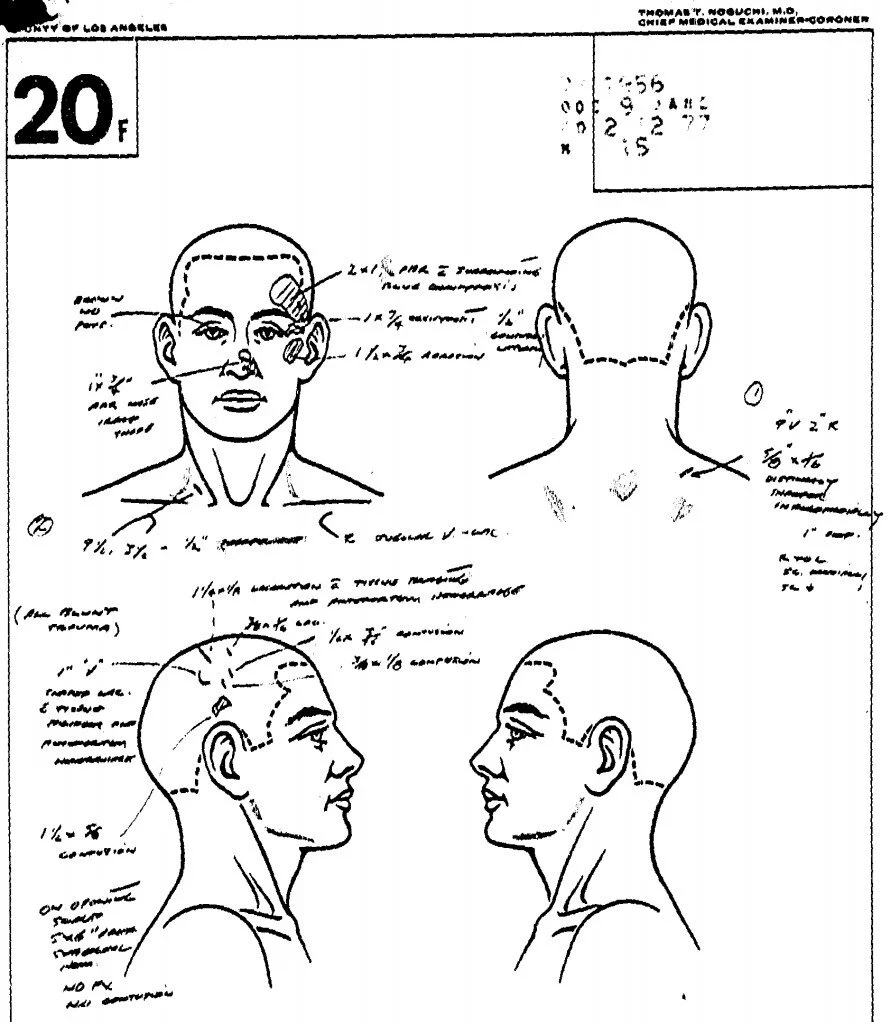 autopsy3.jpg