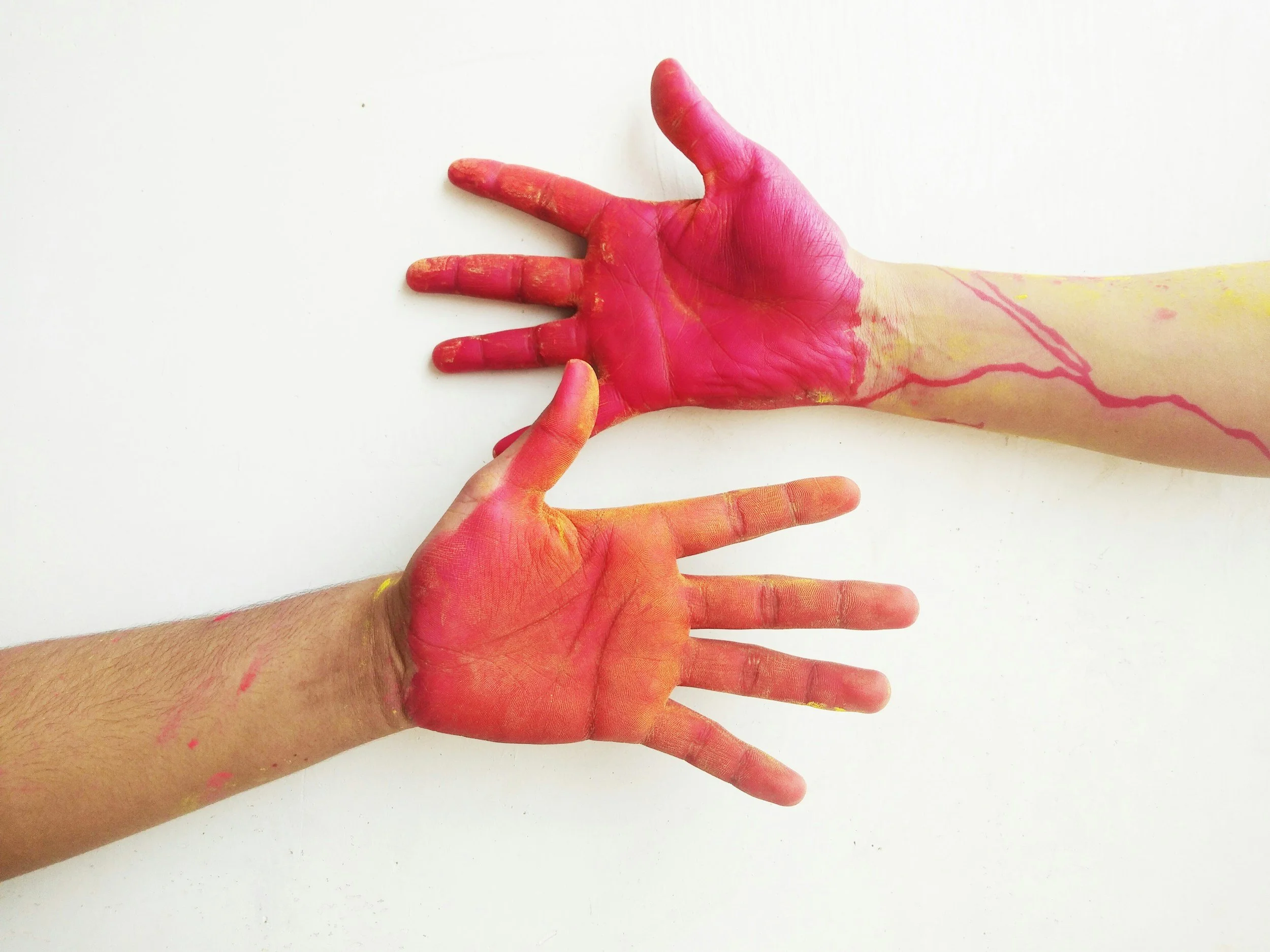 What is Systemic Nickel Allergy?