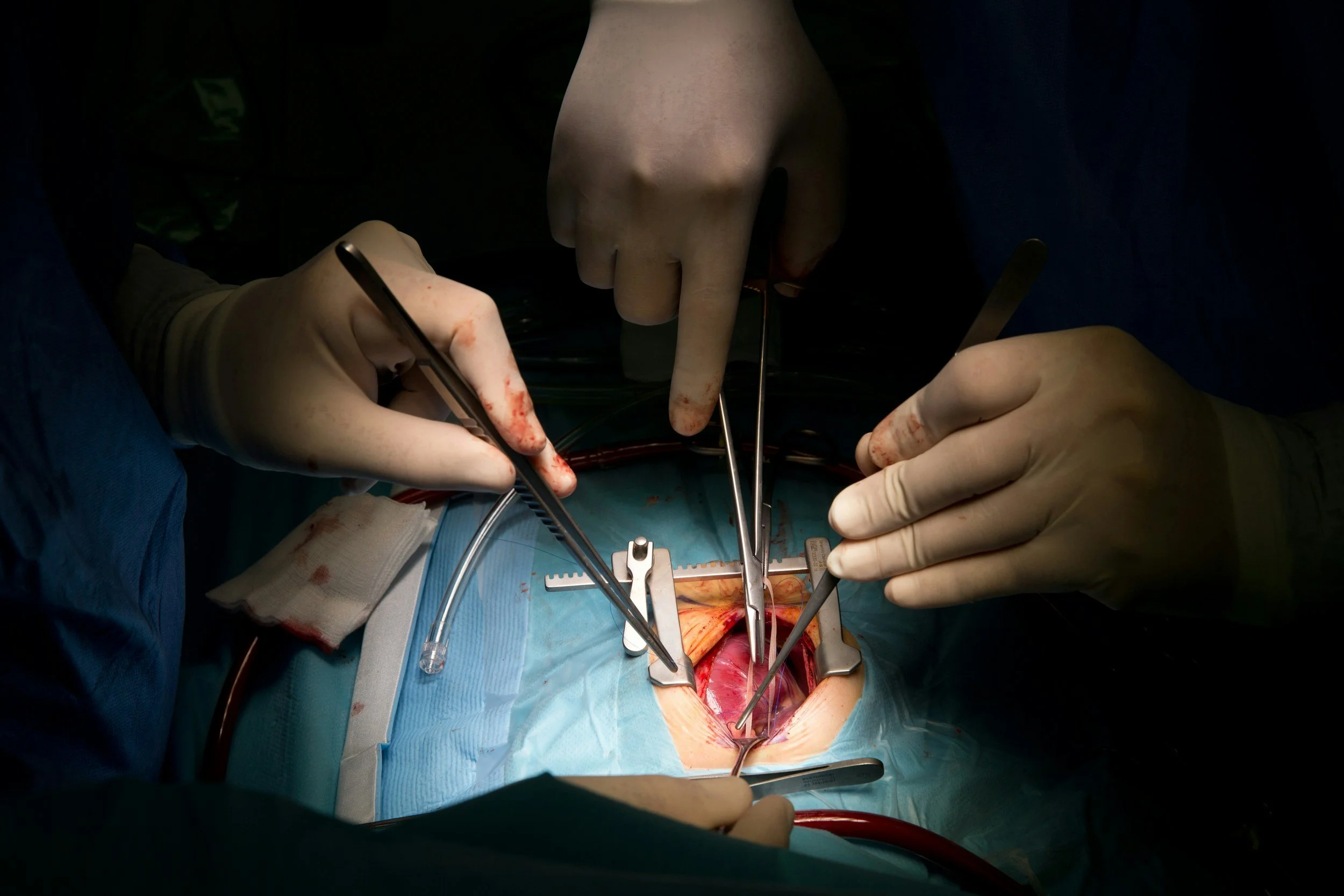 Surgical &amp; Dental Implants &amp; Systemic Nickel Allergy: A Better Framework for the Decision