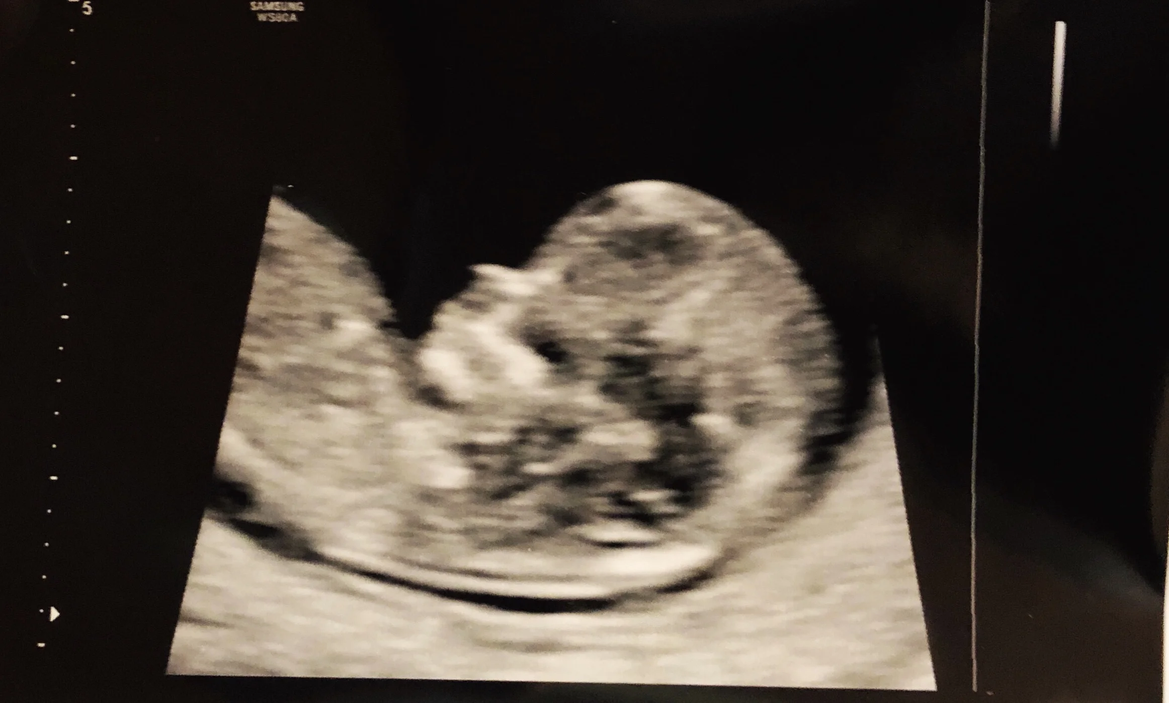 Baby Burke at 12 weeks! Boy or Girl??? I see a boy!