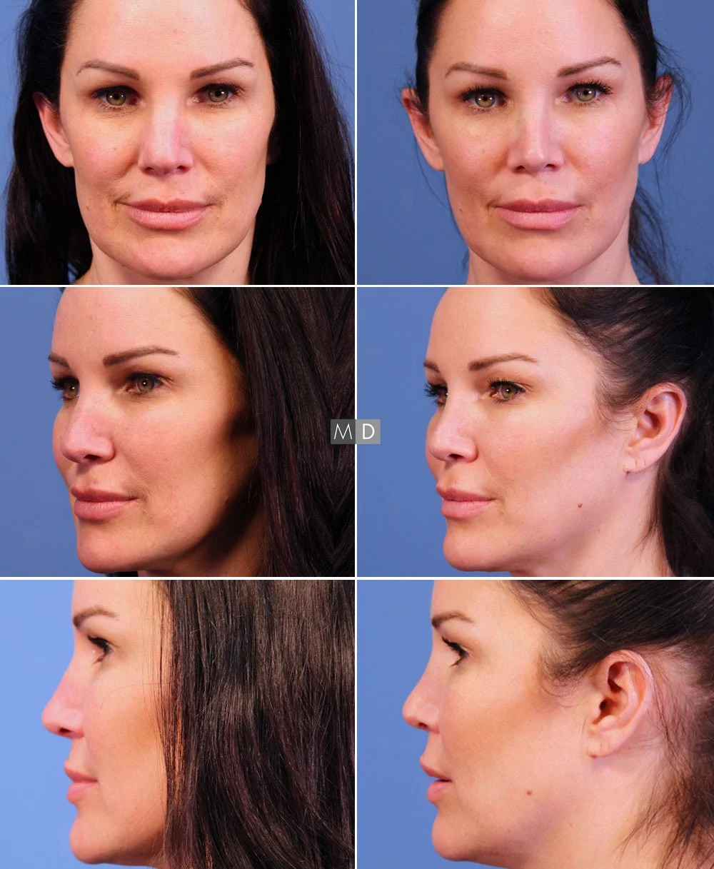 Lemmon Ave. Plastic Surgery & Laser Center