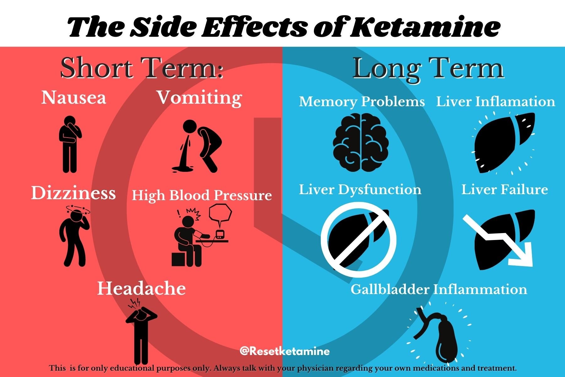 Short term. Nausea. Ketamine for depression. Ketamine Visions. Effect terms