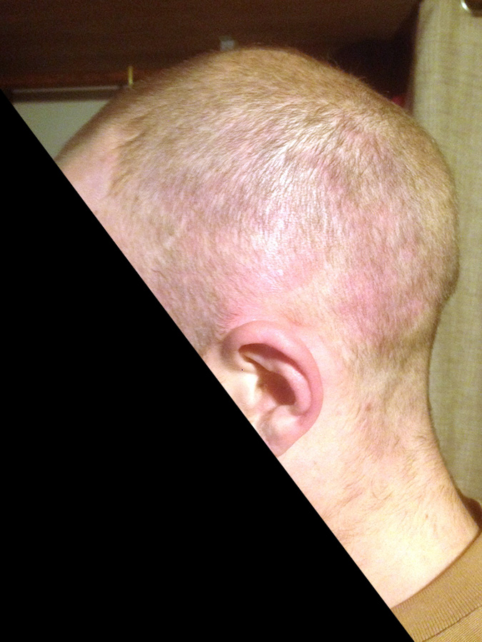 LEFT SIDE