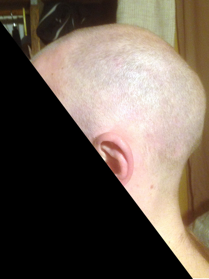 LEFT SIDE