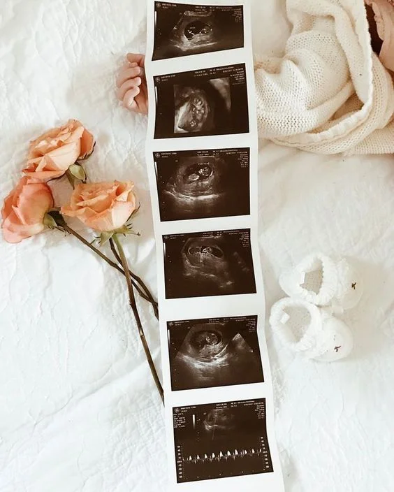 BADANIA PRENATALNE W CIĄŻY (I TRYMESTR) - JAKIE WYKONAĆ ?