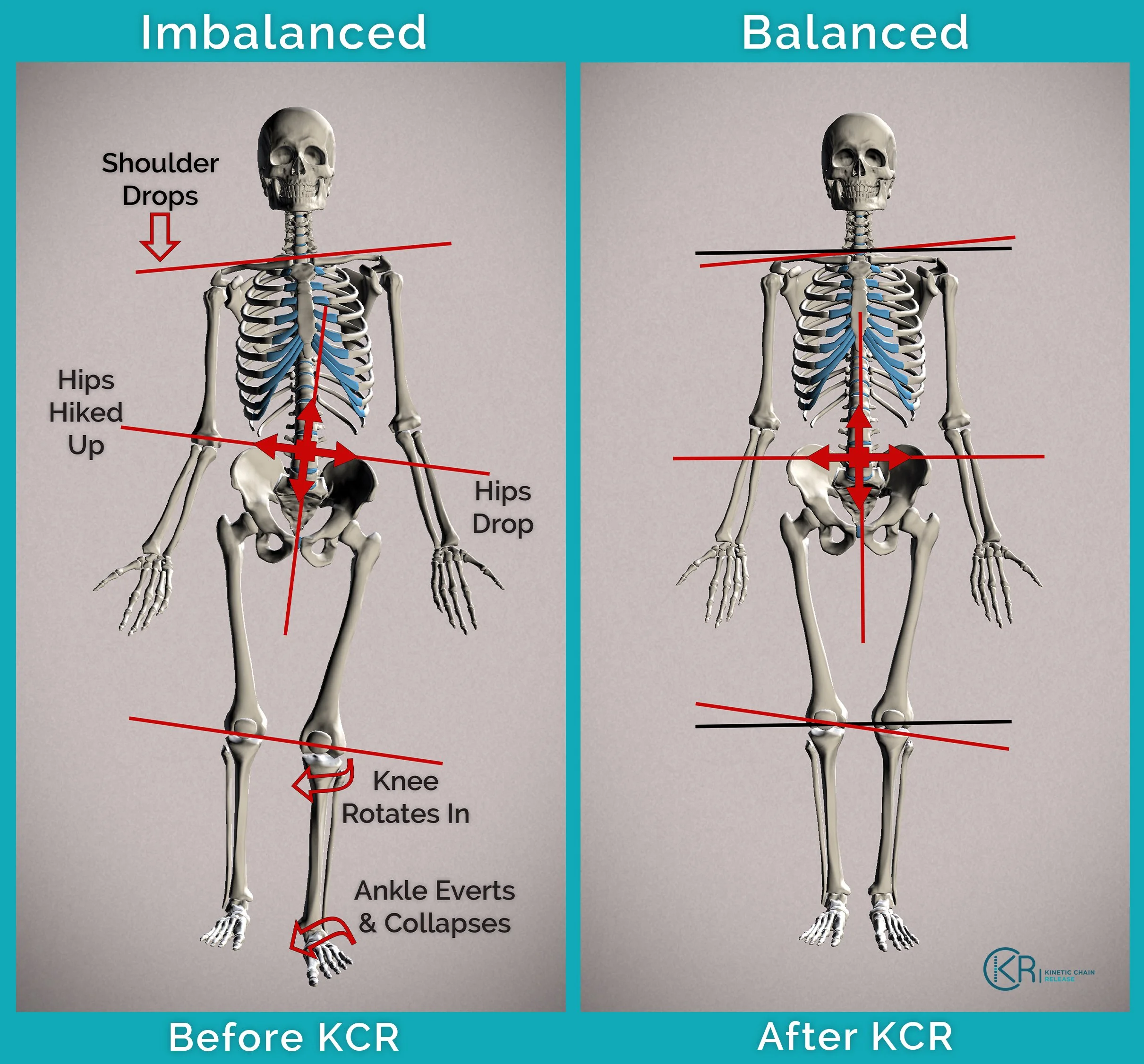 New Skeleton Comparison Readable  V4 copy.jpg