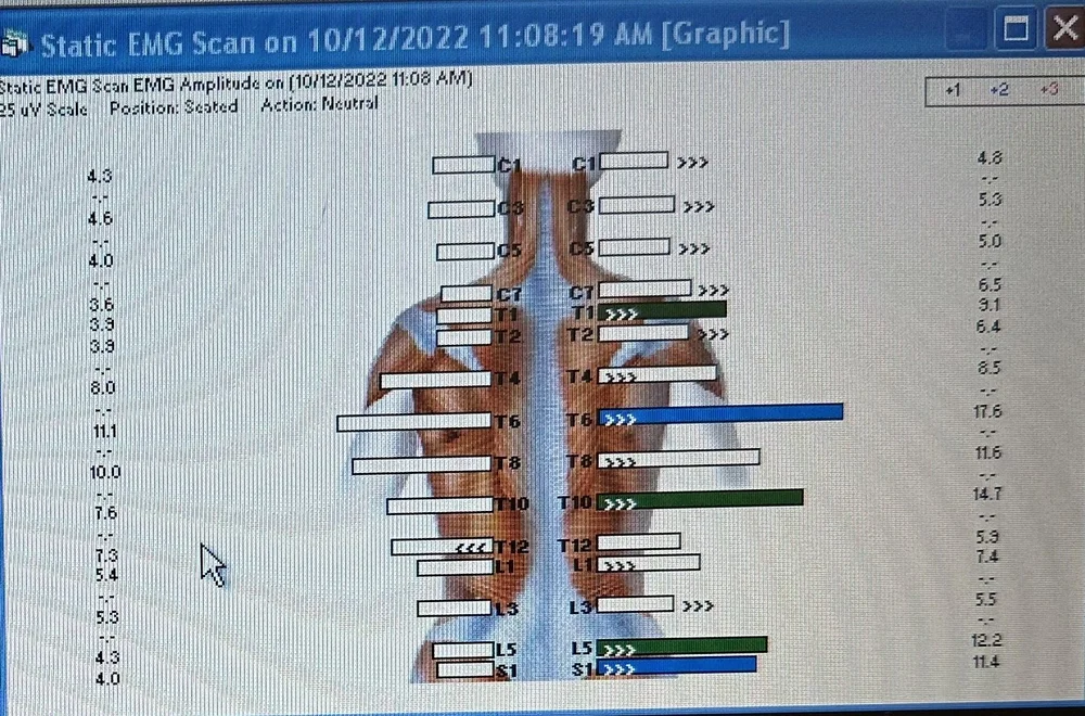 Figure 2 - My Scan Amplitude