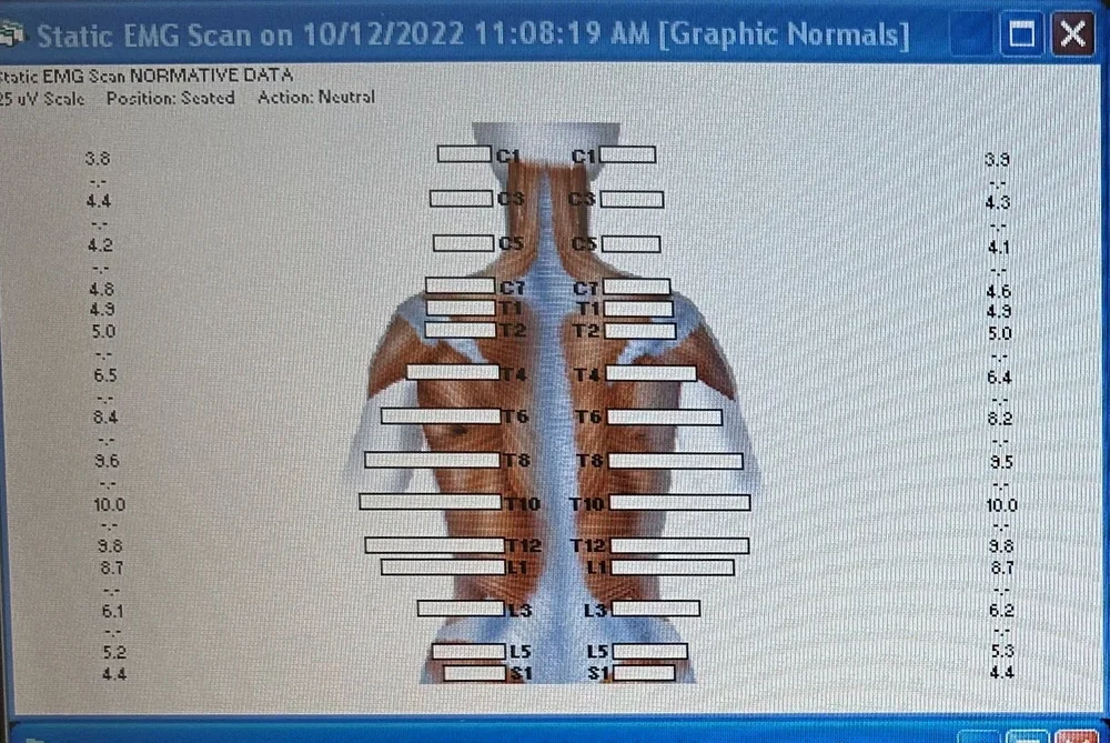 Figure 1 - Normative Data