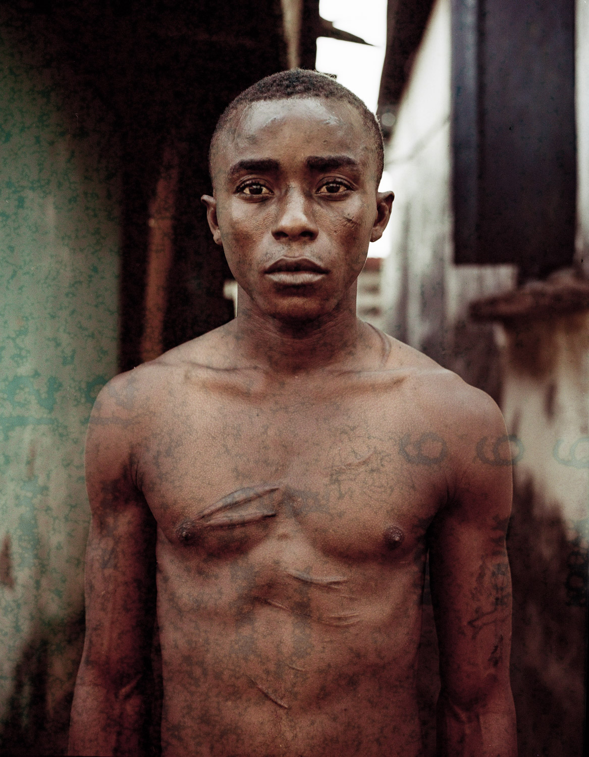 Abdul (21) stands for a portrait in Freetown - Sierra Leone