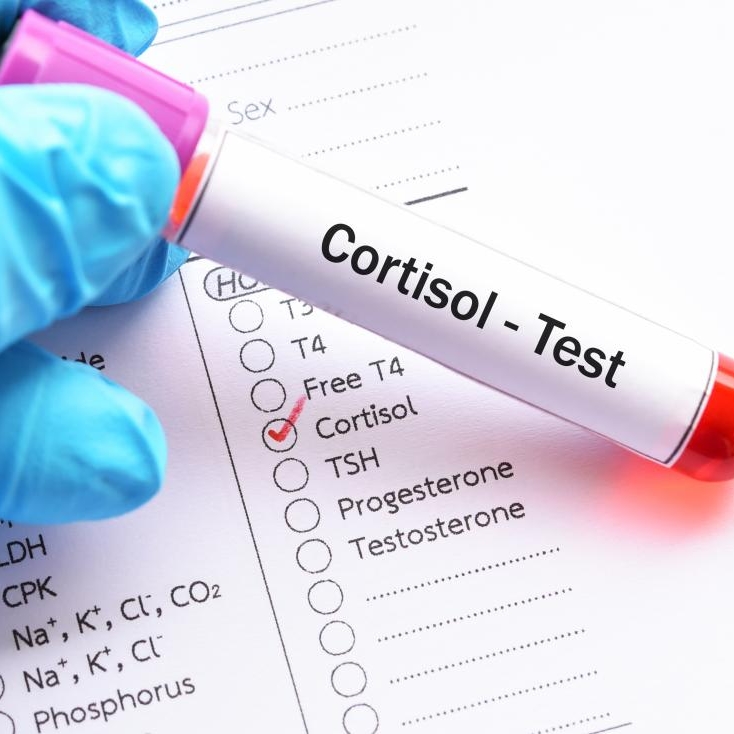 blood-test-for-cortisol.jpg