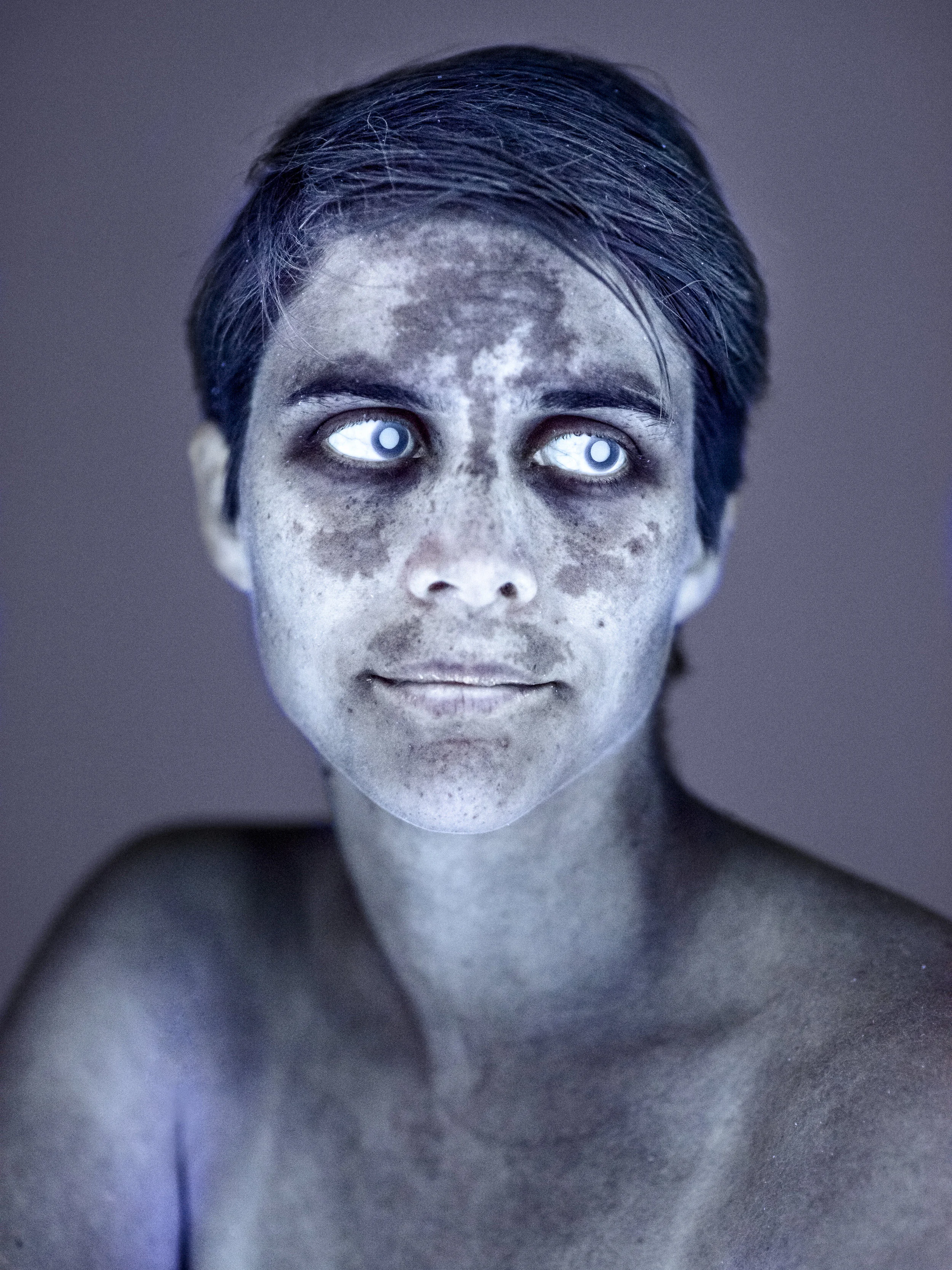 Aus der Serie "Cutis" | Simon von Gunten