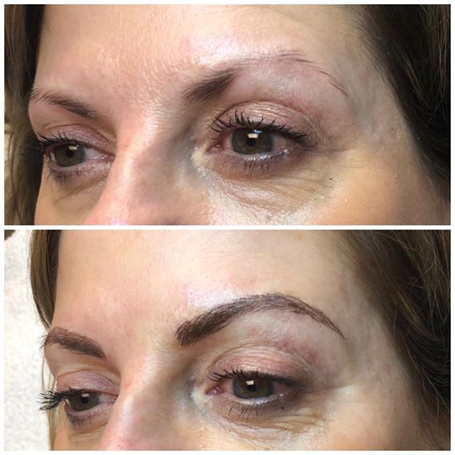 &ldquo;Another Microblading before and after for those still on the fence! This client today said what every client says &ldquo;I can hear you working but I can&rsquo;t feel it!&rdquo; It&rsquo;s pain free, loves! I have some great numbing cream that