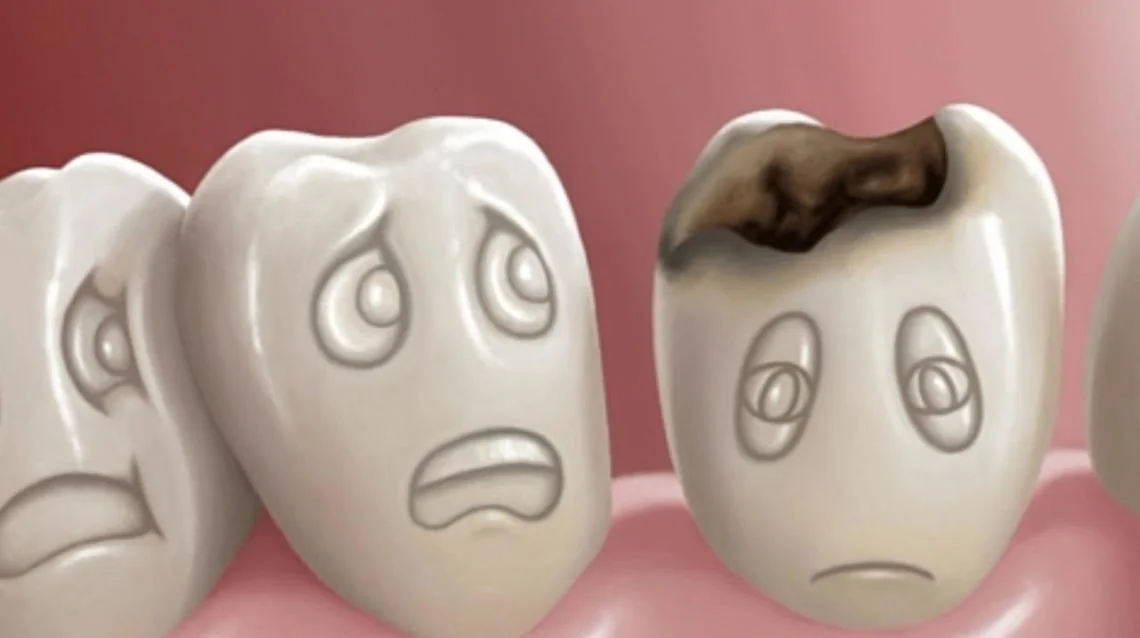 teeth.jpeg