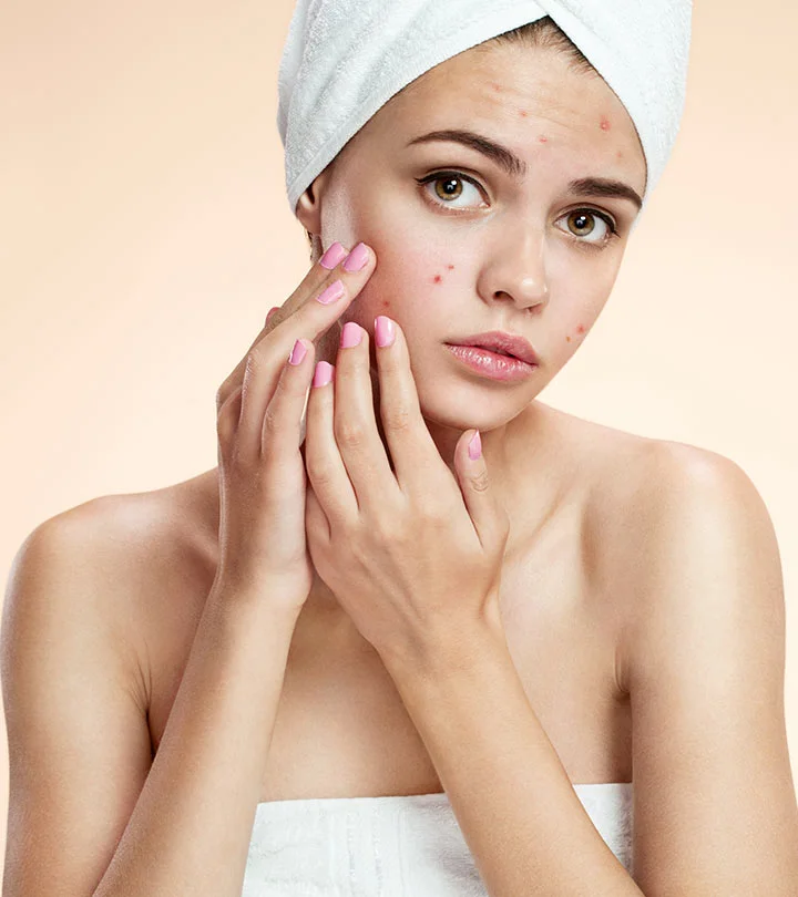 Different-Types-Of-Acne-And-How-To-Treat-Them-Effectively.jpg