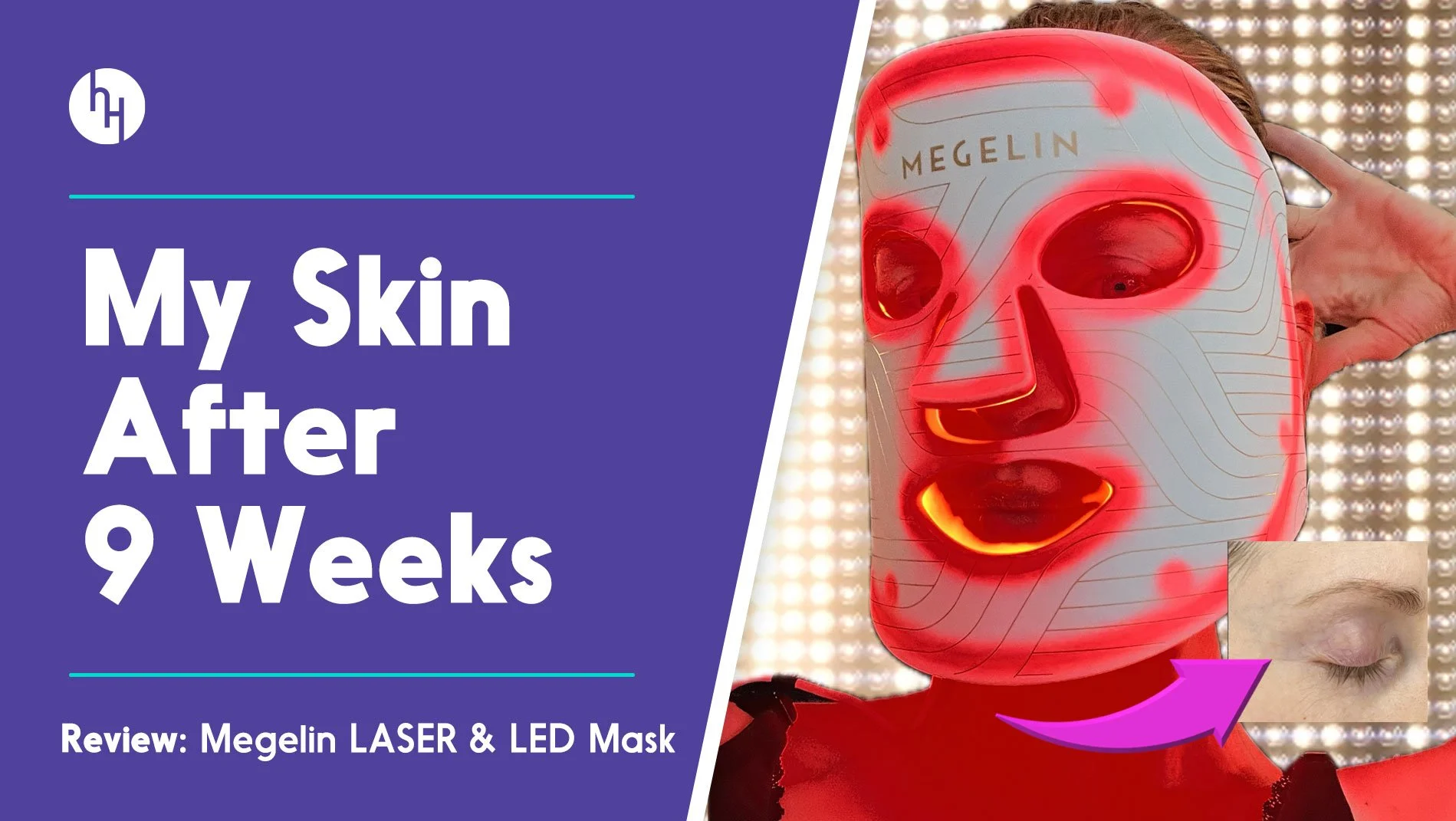Megelin Anti-Aging Laser &amp; LED Mask Review
