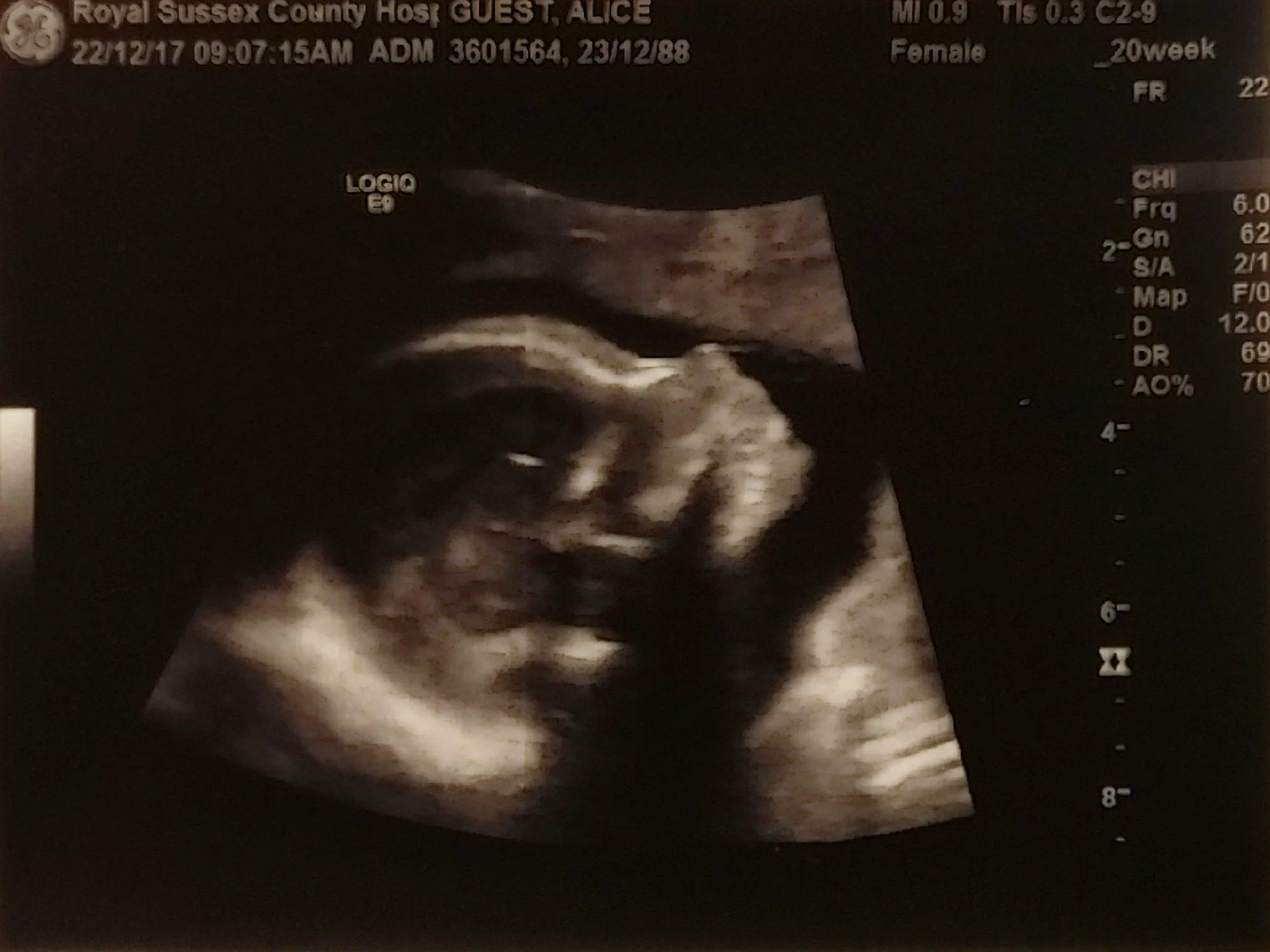 #6 Baby movements and Heartburn