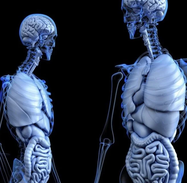 How to Prevent Inflammation in the Colon: Avoiding Colon Cancer