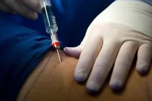 Navigating the Ins and Outs of  Anesthesia Reviews