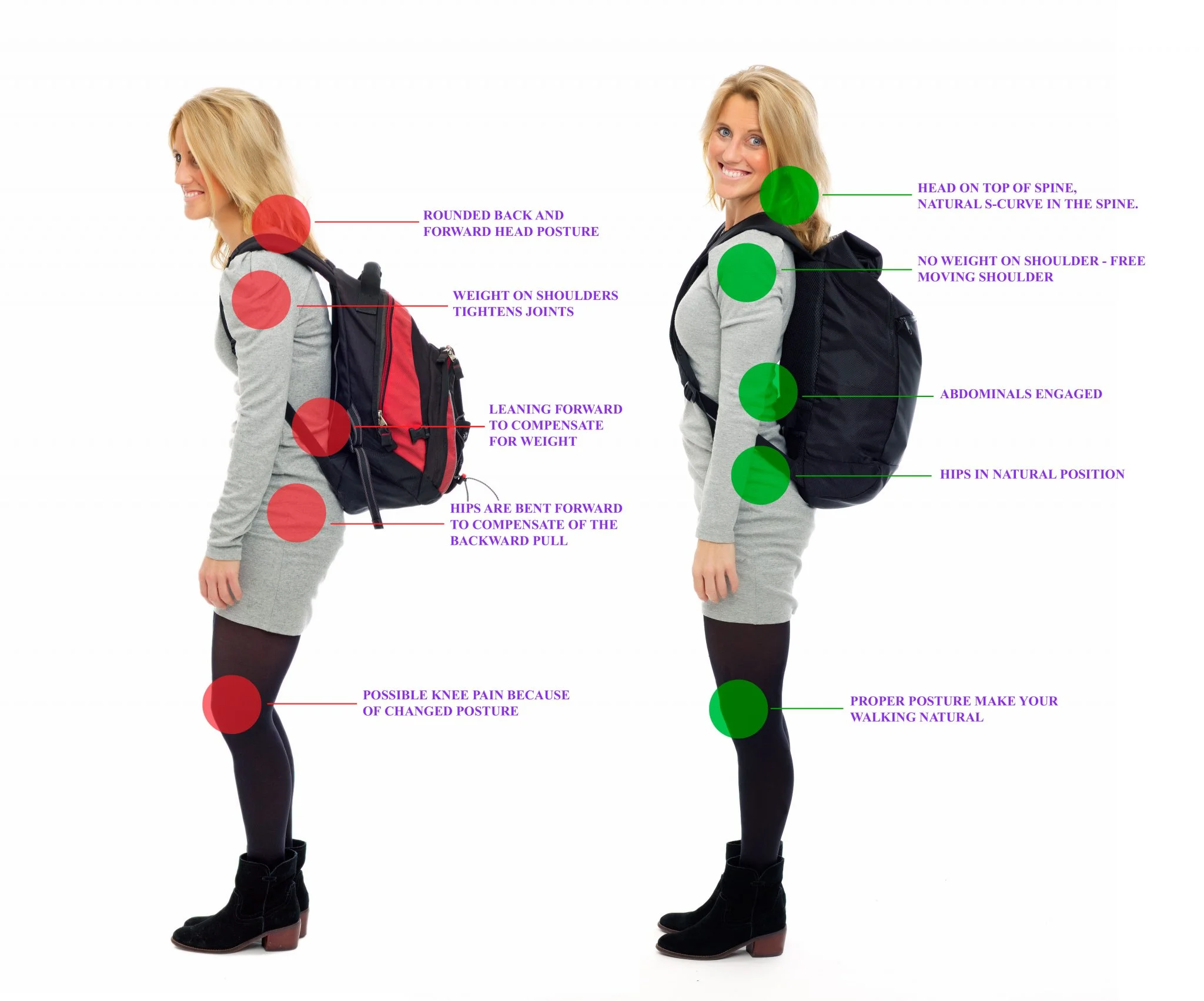 backpack shoulder pain