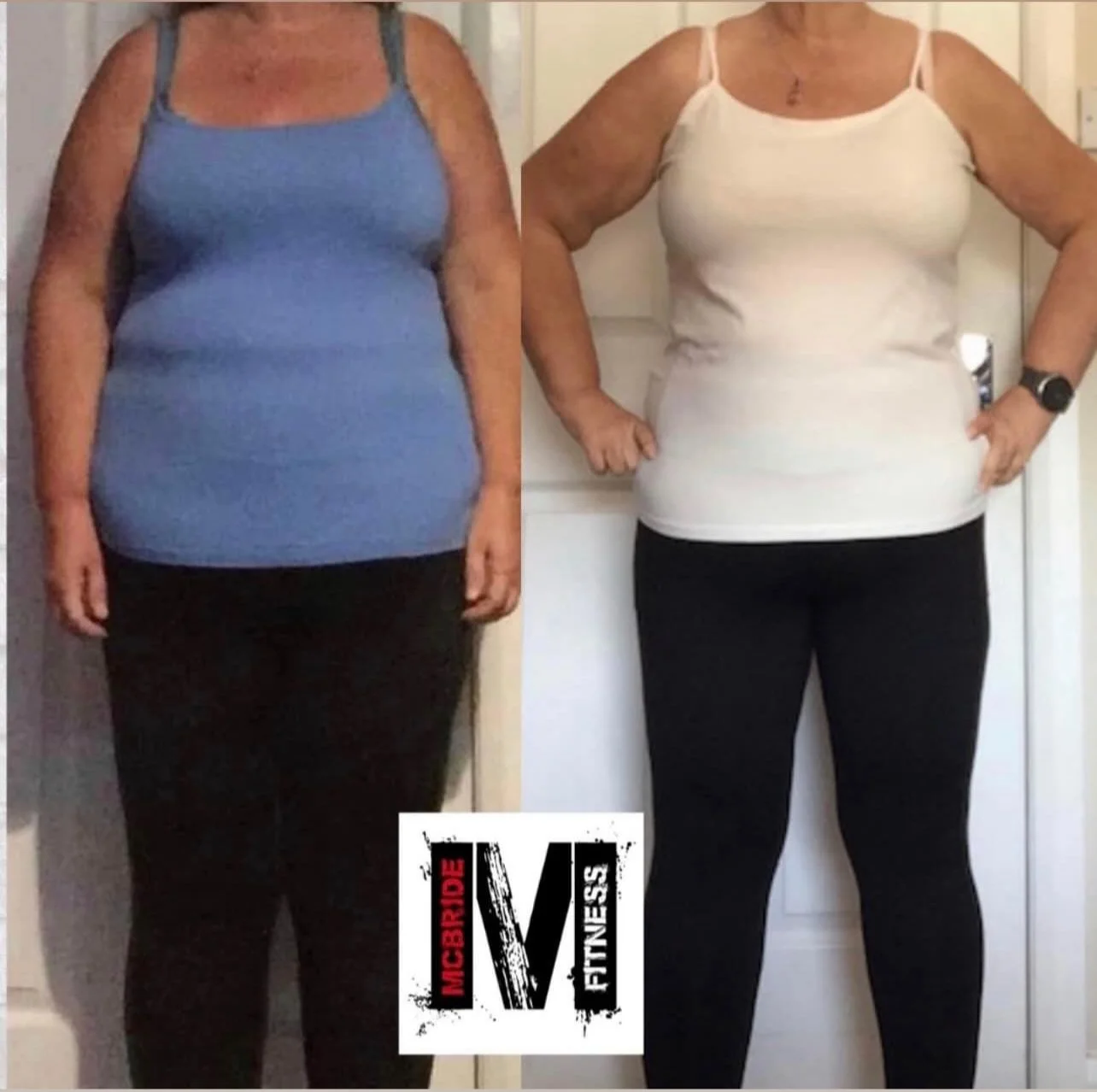 Side-by-side client progress photographs with face out of frame