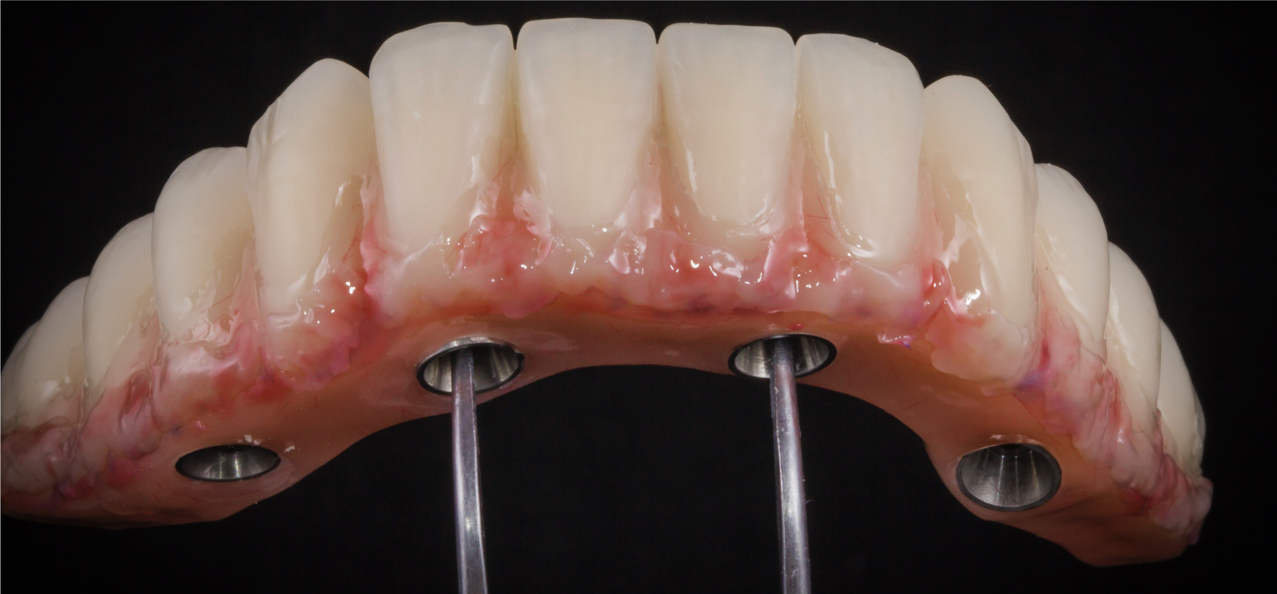 Blood in the gums.jpg