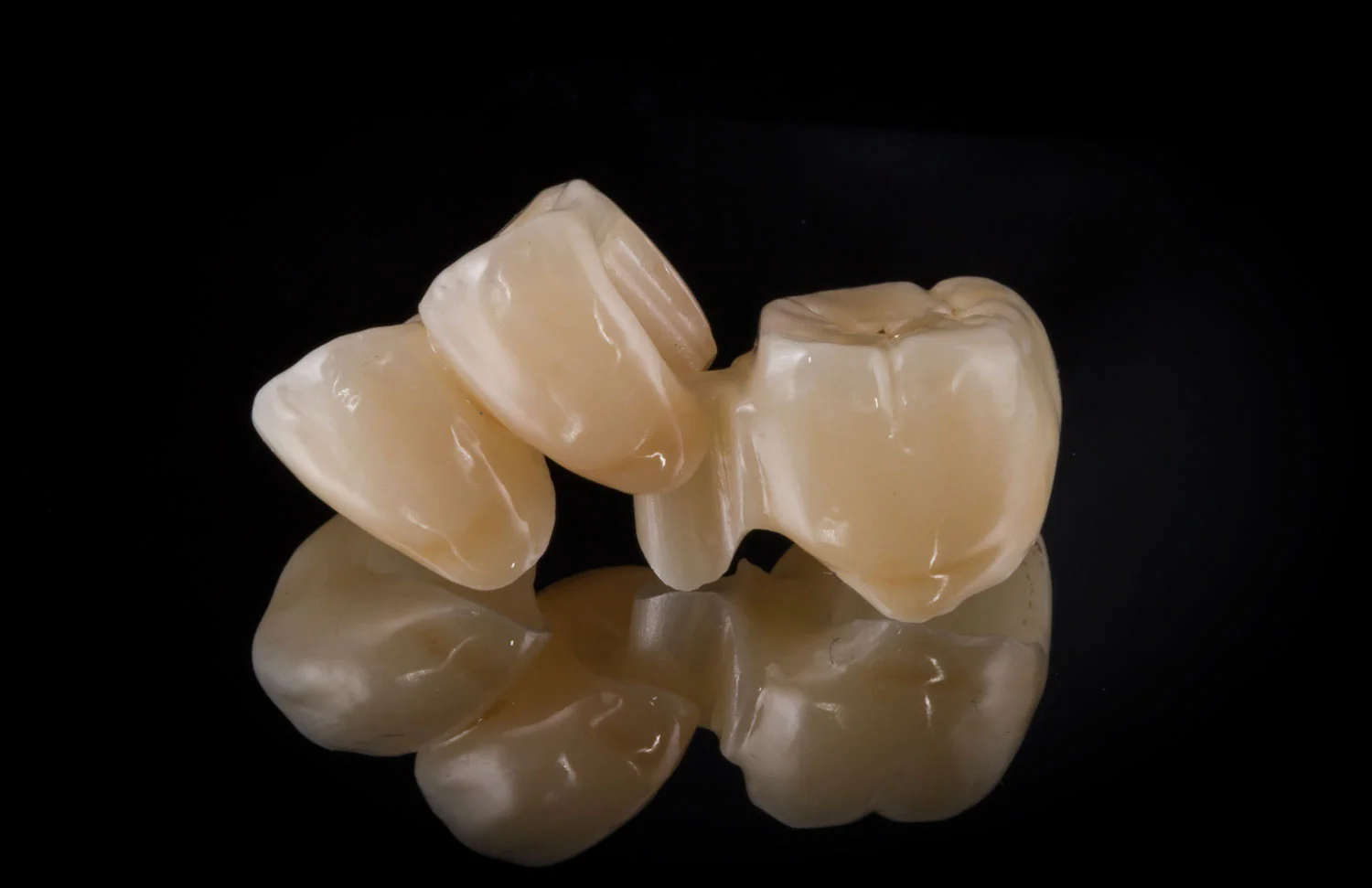 Monolithic Zirconia Bridge