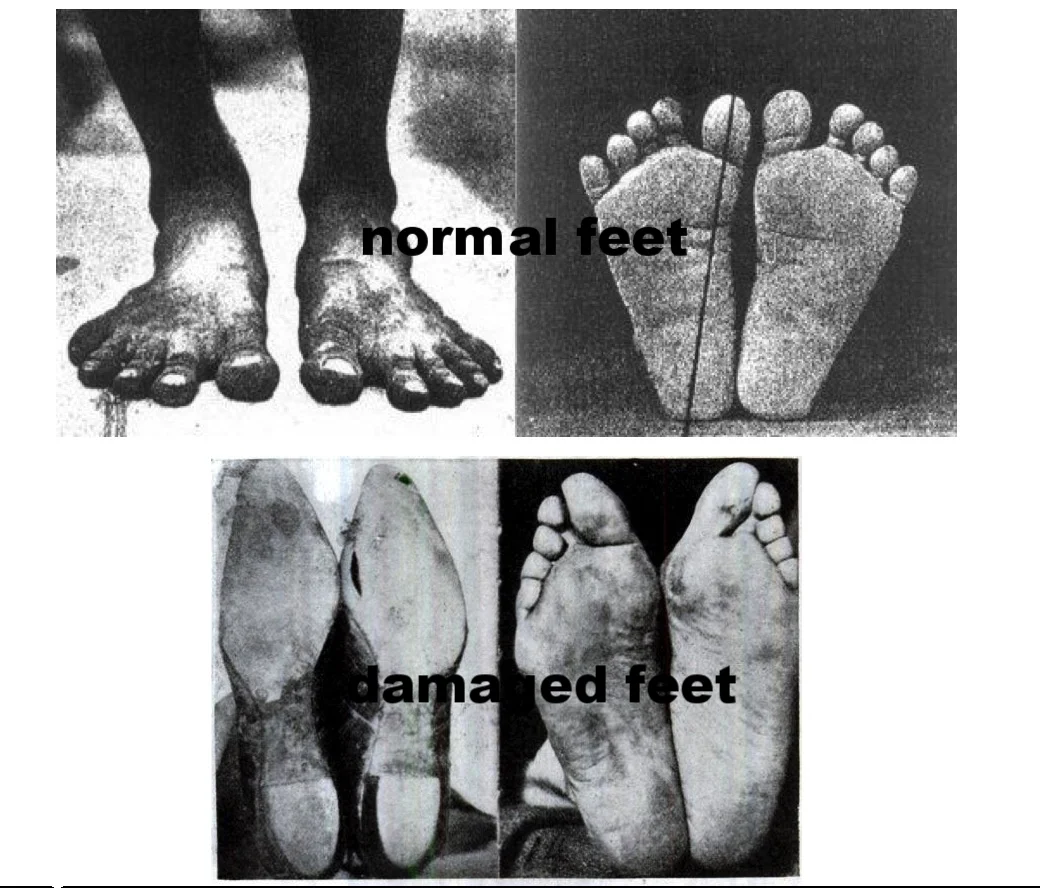 running barefoot better than shoes