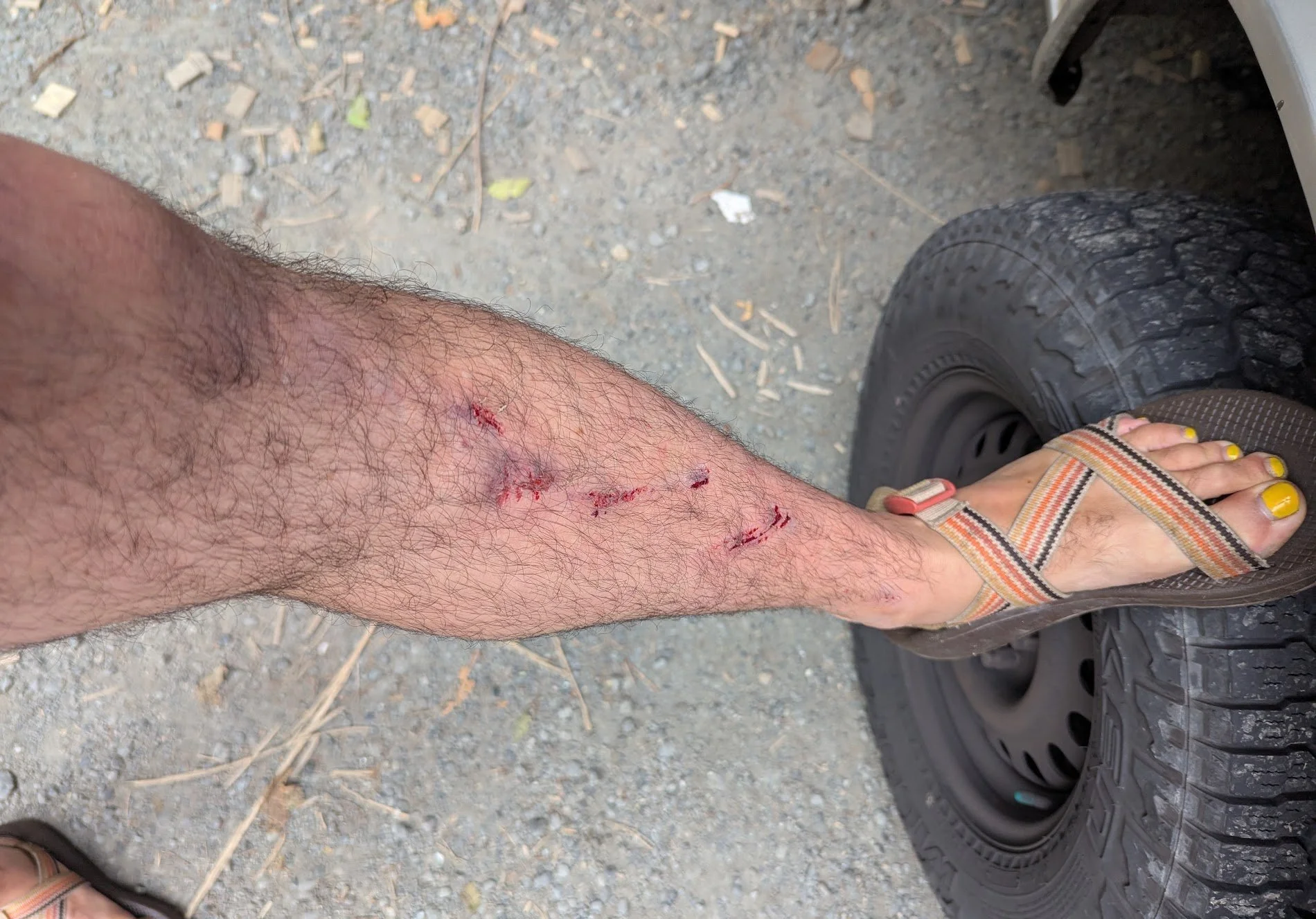 June 23rd, 2025 - Any Human Heart