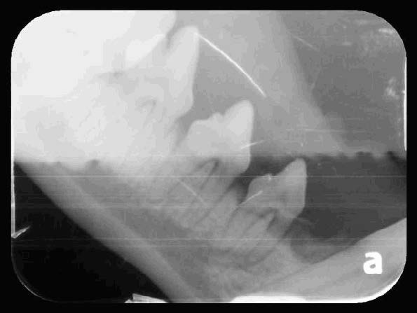 Yuki's Oral Cavity Radiographs