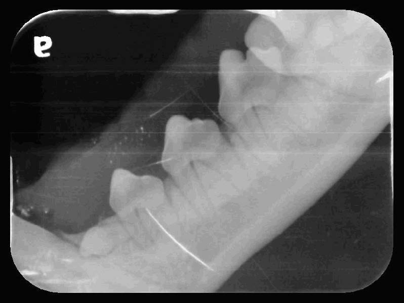 Yuki's Oral Cavity Radiographs