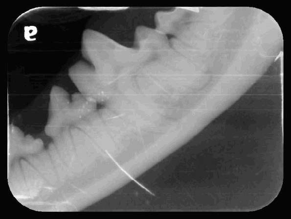 Yuki's Oral Cavity Radiographs